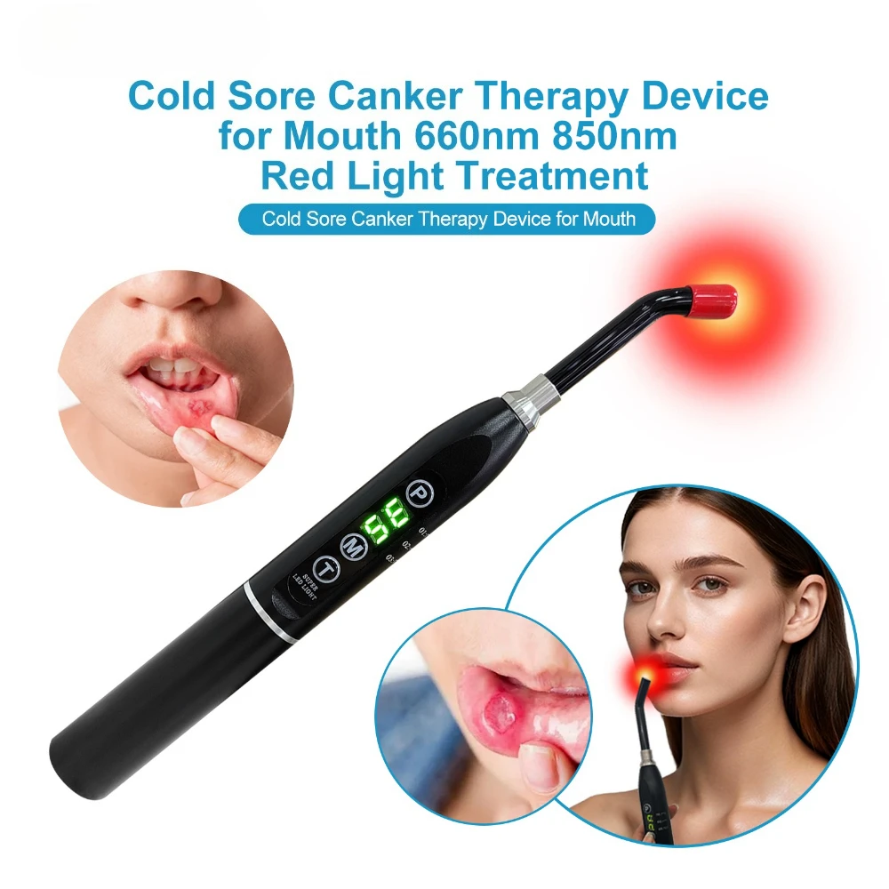 

Frovab Cold Sore Canker, палочка для физиотерапии полости рта, ручное красное инфракрасное устройство для терапии, 660 нм, 850 нм, облегчение боли в теле