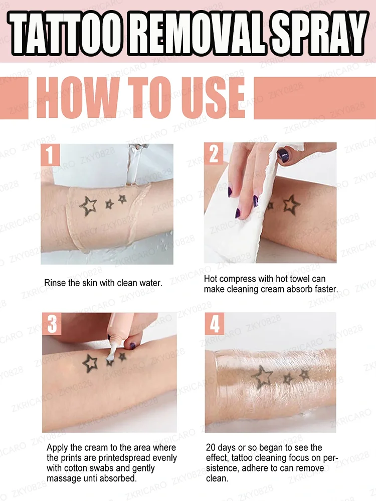 كريم إزالة الوشم السريع يخفف إزالة الوشم بشكل دائم