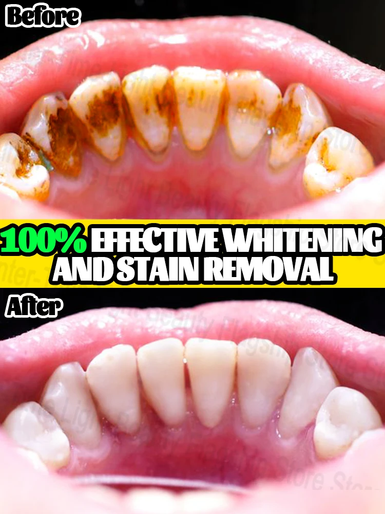 

Glowing white! Amazing effect!