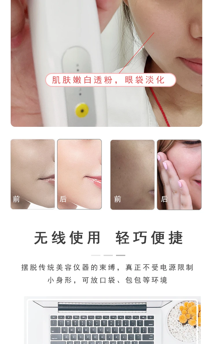 Free Shipping Firming Lifting Eye Beautification Instrument Facial Essence Inductive Therapeutical Instrument Eye Fade Eye