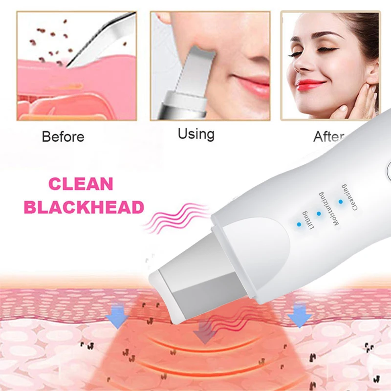Blackhead Scraper Electric Pore Cleaner Acne Removal Exhaust Instrument Suction Wonder Ultrasonic Peeler