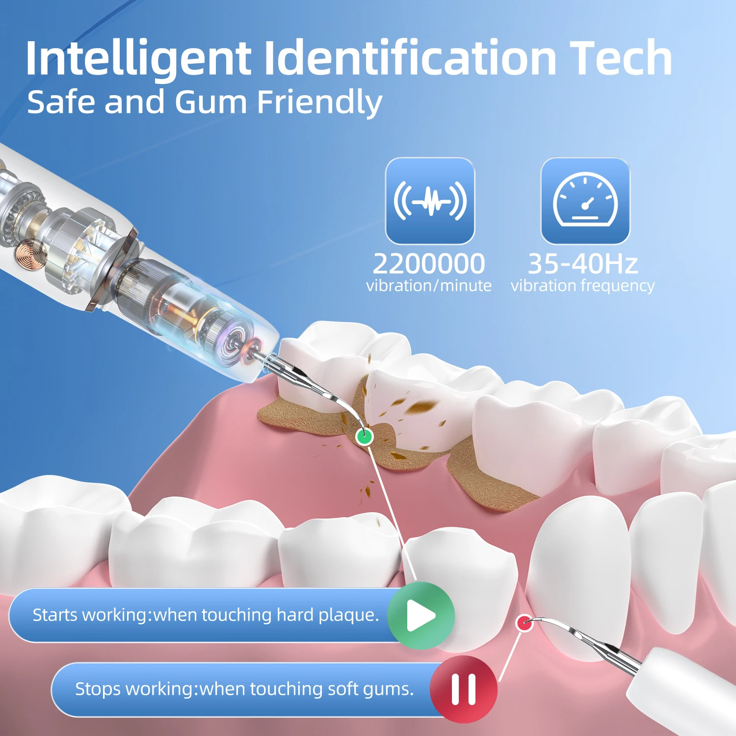 Elektrische Dental Scaler Für Zähne Zahnstein Eliminator Ultraschall Zahn Reiniger IPX6 Fünf Modi Zahn Zahnstein Entfernung Bleaching