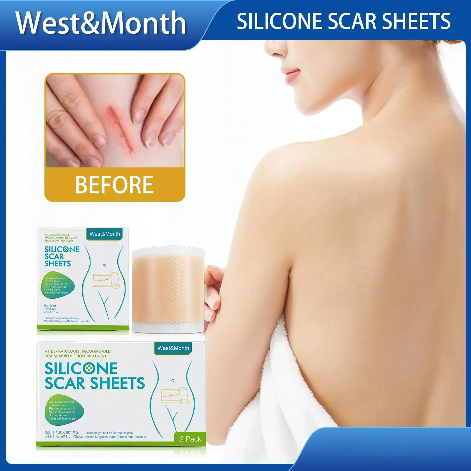 3 Rotoli di Silicone Cicatrice Lenzuola Riparazione Della Pelle Patch di Rimozione Autoadesiva Smagliature Nastro Terapia Patch Bruciare Acne Cicatrice Cura Della Pelle