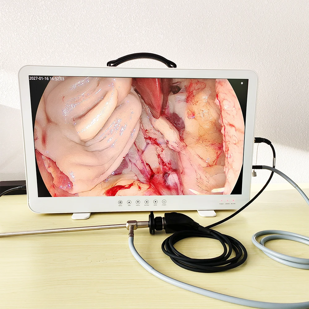 Camjoy 27 Inch Portable 4 in 1 Medical Diagnostic Endoscope  with Integrated Video System
