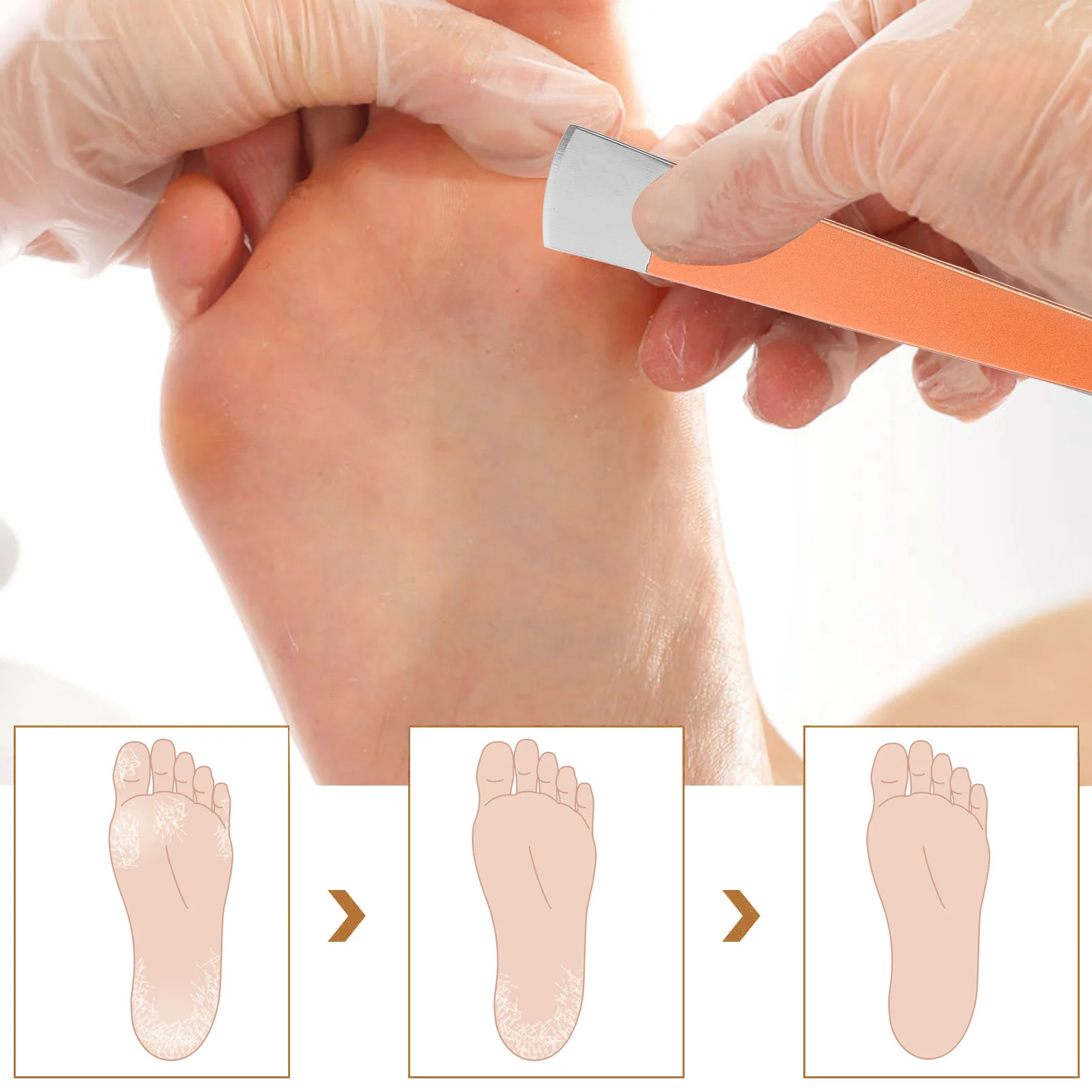 

1 set PedicureKit FootCare Tools Reusable StainlessSteel Trimming IngrownToenail Knife Set Professional Home Use