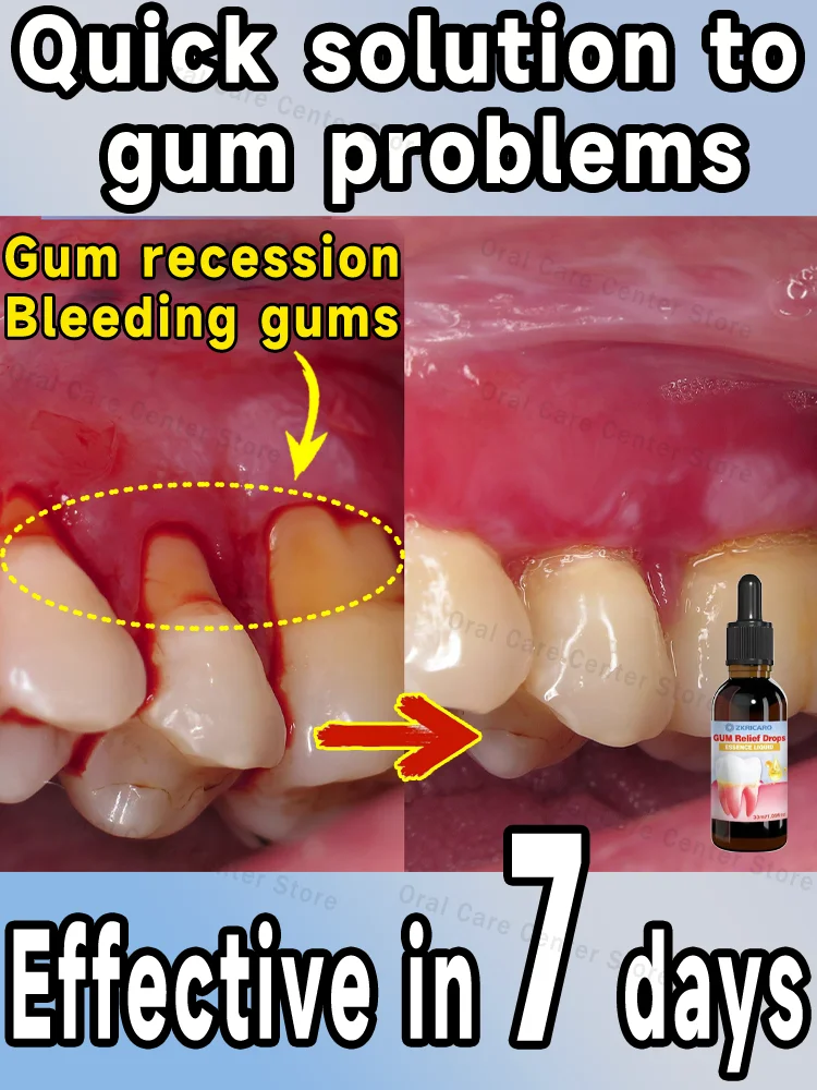 

Give you healthy gums, quickly relievetoothache, repair damaged gums
