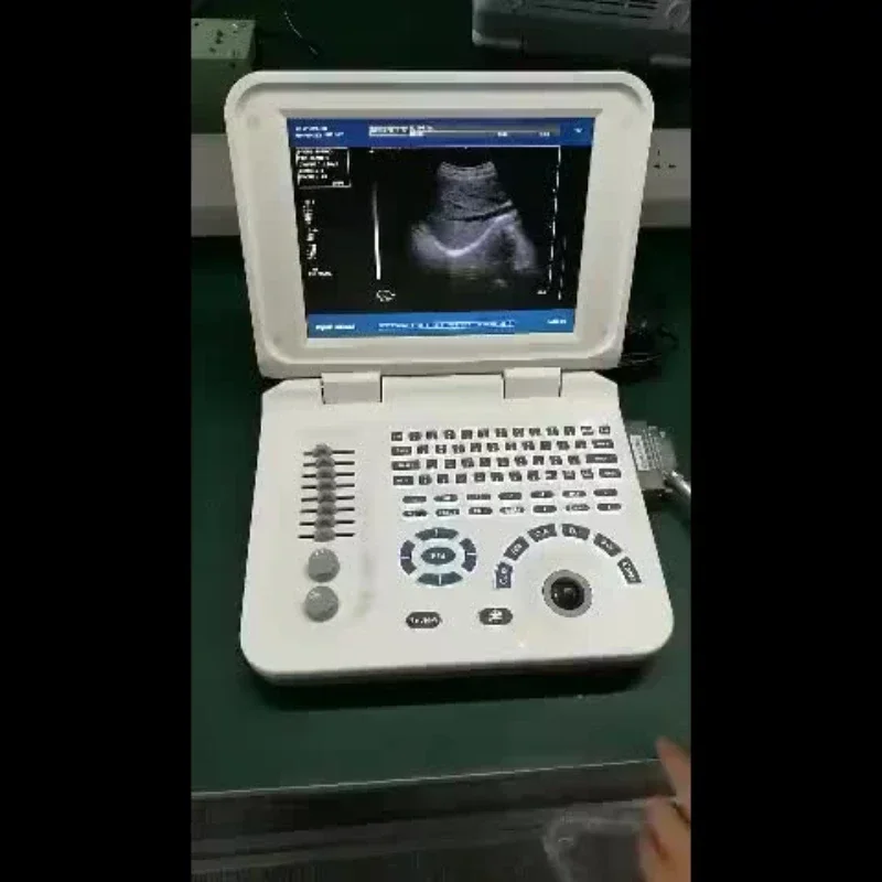 Wholesale factory direct sales fashionable pregnancy ultrasound