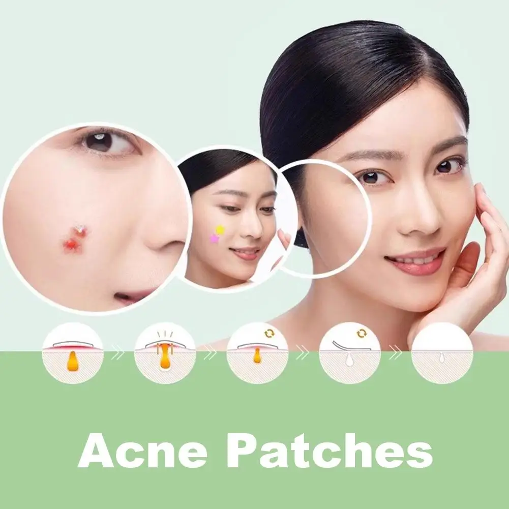Hydrocolloid Acne Patch Concealer Patch Fade Acne Blackheads And Closed Waterproof Breathable Acne Skin Patch Makeup Tool