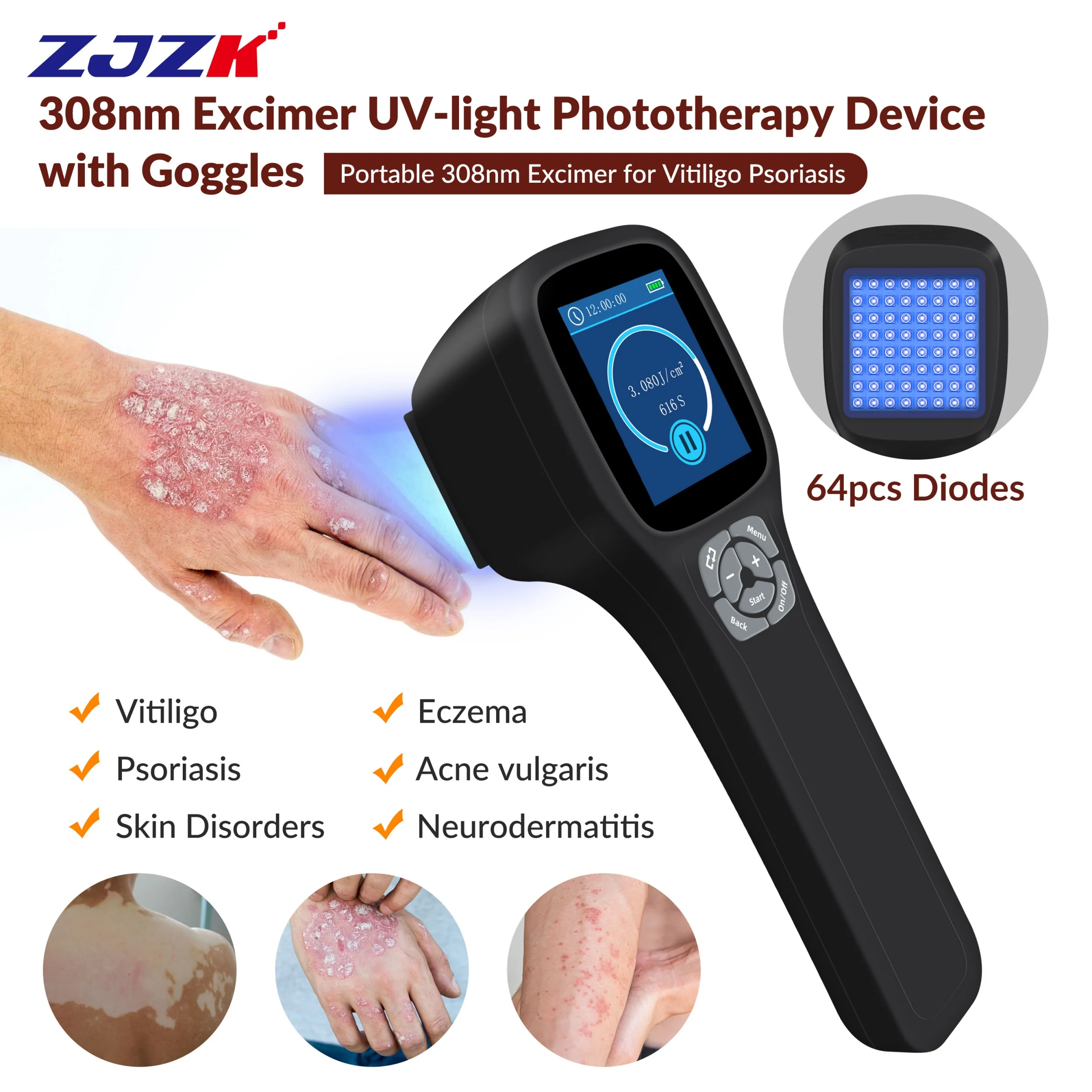 In stock 2026 Narrowband 308nm UVB Light Lamp Handheld Ultraviolet Derma Phototherapy Box for Private Home Therapy on Hands Skin