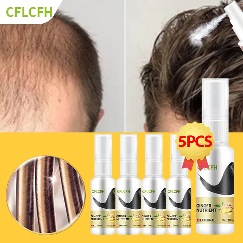 Hair Growth Spray for Ginger Scalp Damaged Treatement Liquid Prevent Hair Loss Effective Fast Growth Massage Liquid