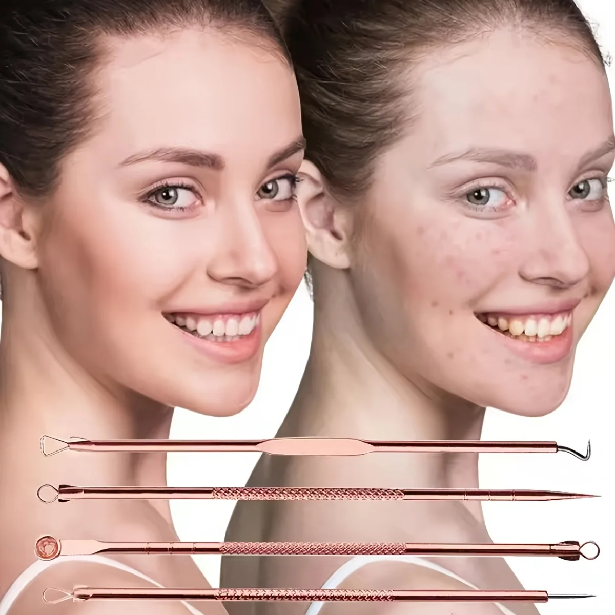 1/4/6pcs Acne Needle Multicolor Acne Blackhead Needle Black Spot Acne Blemish Skin Care Women's Beauty Acne Care Pore Cleaner