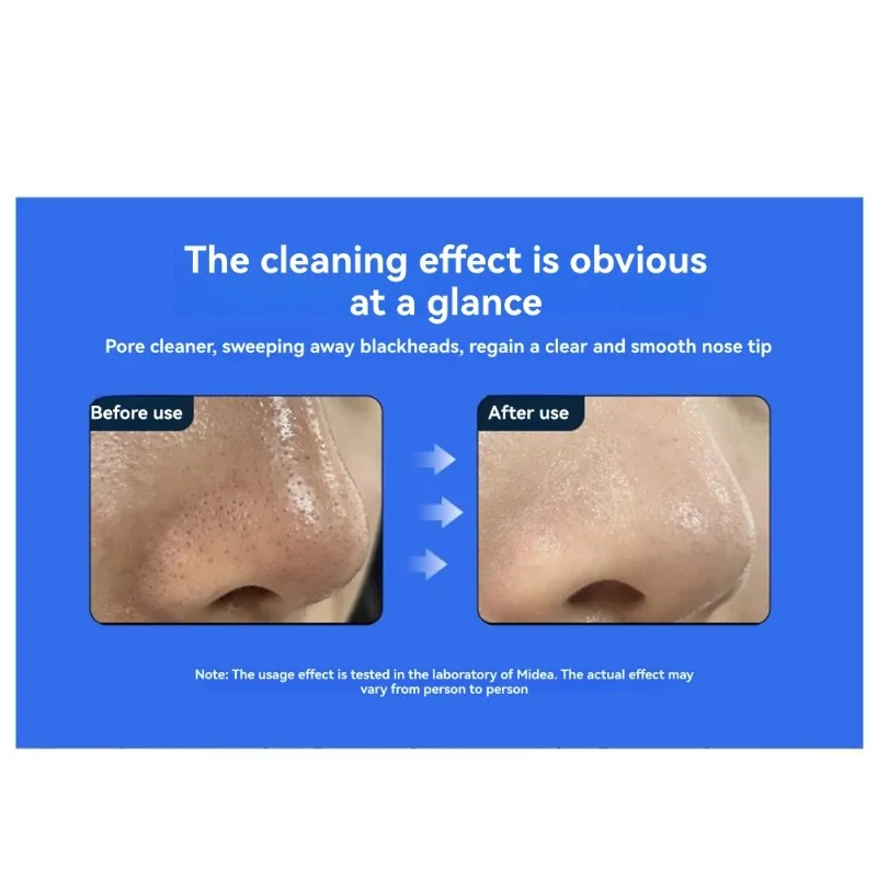 【SURPRISE】جهاز تجميل مع تعديل السرعة المزدوجة - أداة تنظيف المسام - منظف المسام الكهربائي - مزيل الرؤوس السوداء #3