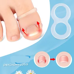 5Pcs Silicone Ingrown Toenail Correction Tool Invisible Ingrown Toe Nail Treatment Elastic Straightening Clip Brace Pedicure