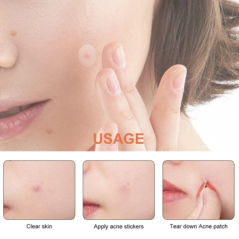 Gezichtsreparatie Acne Schone poriën Hydrateren en gladde huid Acne Patch Gezichtsstickers Huidverzorgingshulpmiddelen