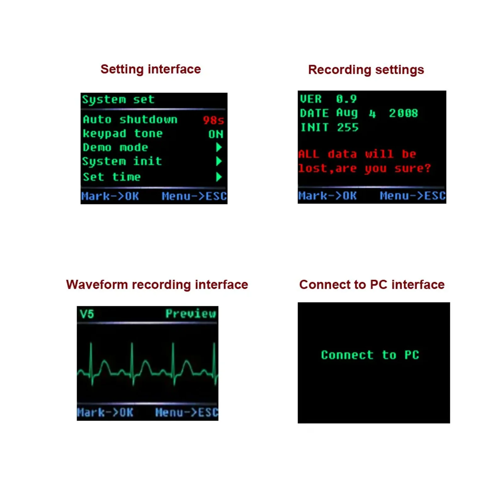 ECG Contec TLC5000 12 Channel Holter ECG 24 Hours Oscilloscope Holter EKG Monitor Software Monitor portátil holter monitor 24h