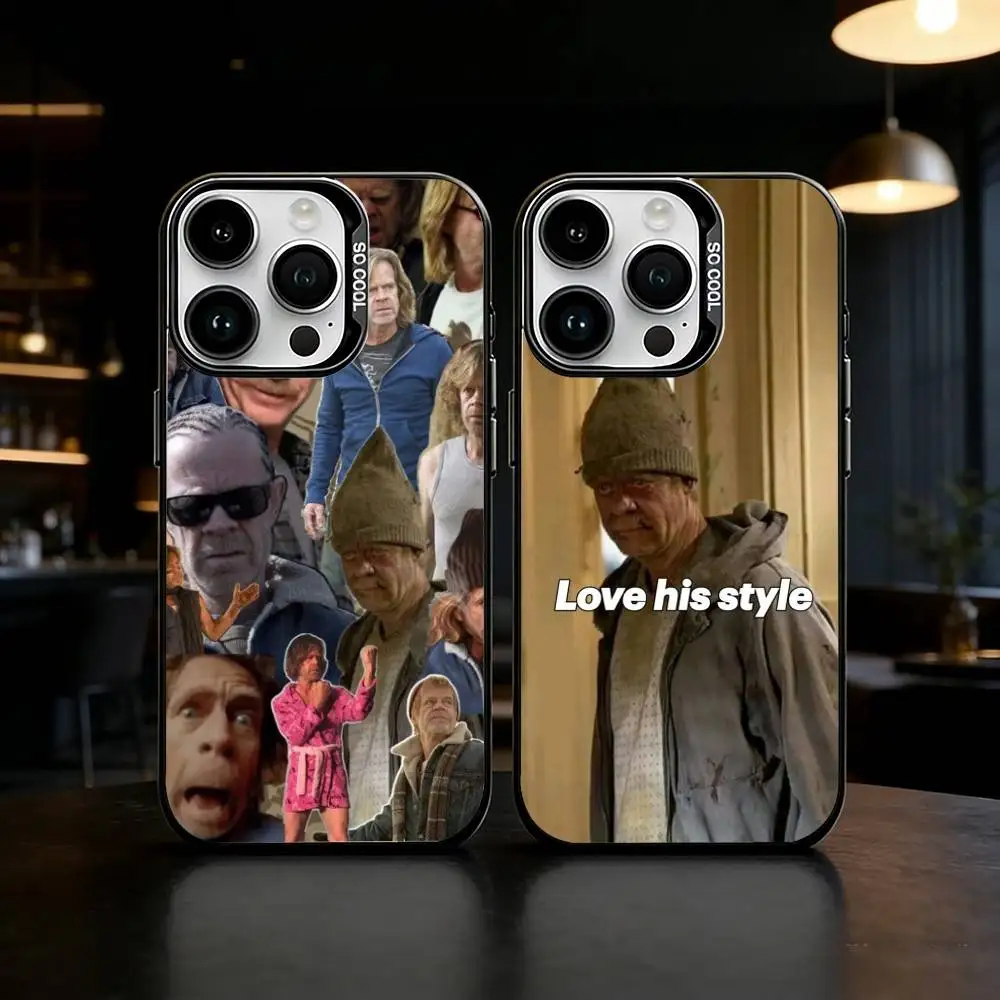 

Frank Gallagher S-Shameless Phone Case Color Silver Shell For IPhone 17 16 15 14 13 12 11 Pro Max Plus