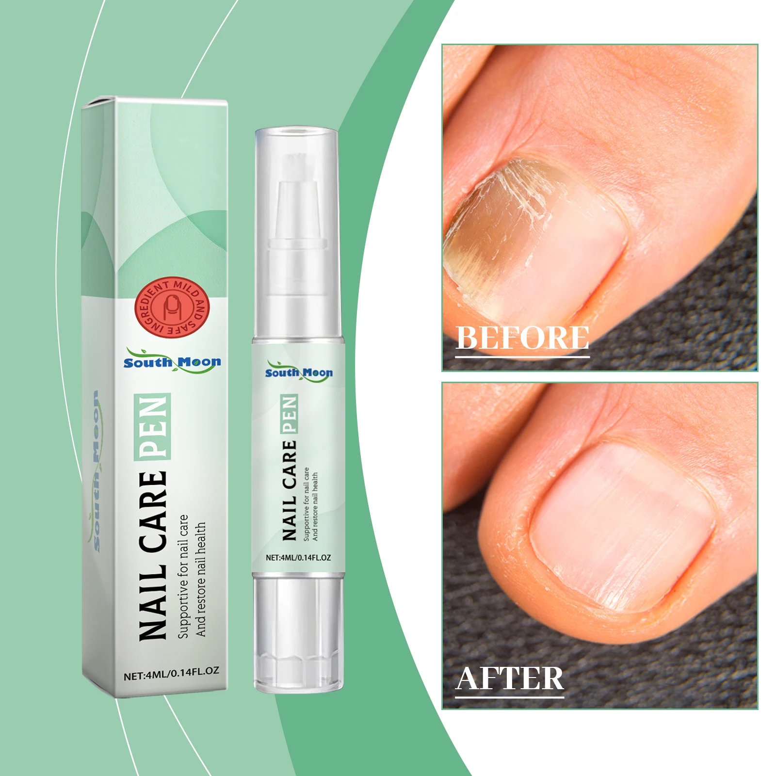 Nail Fungus Care Pen gently nourishes hand and toenails, cleans and brightens nails, improves thick and damaged nails.