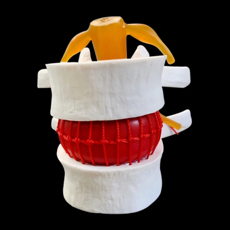 Spine Human Spine Model Full Size Demonstration Model Of Human Lumbar Intervertebral Disc Compression For Medical Teaching