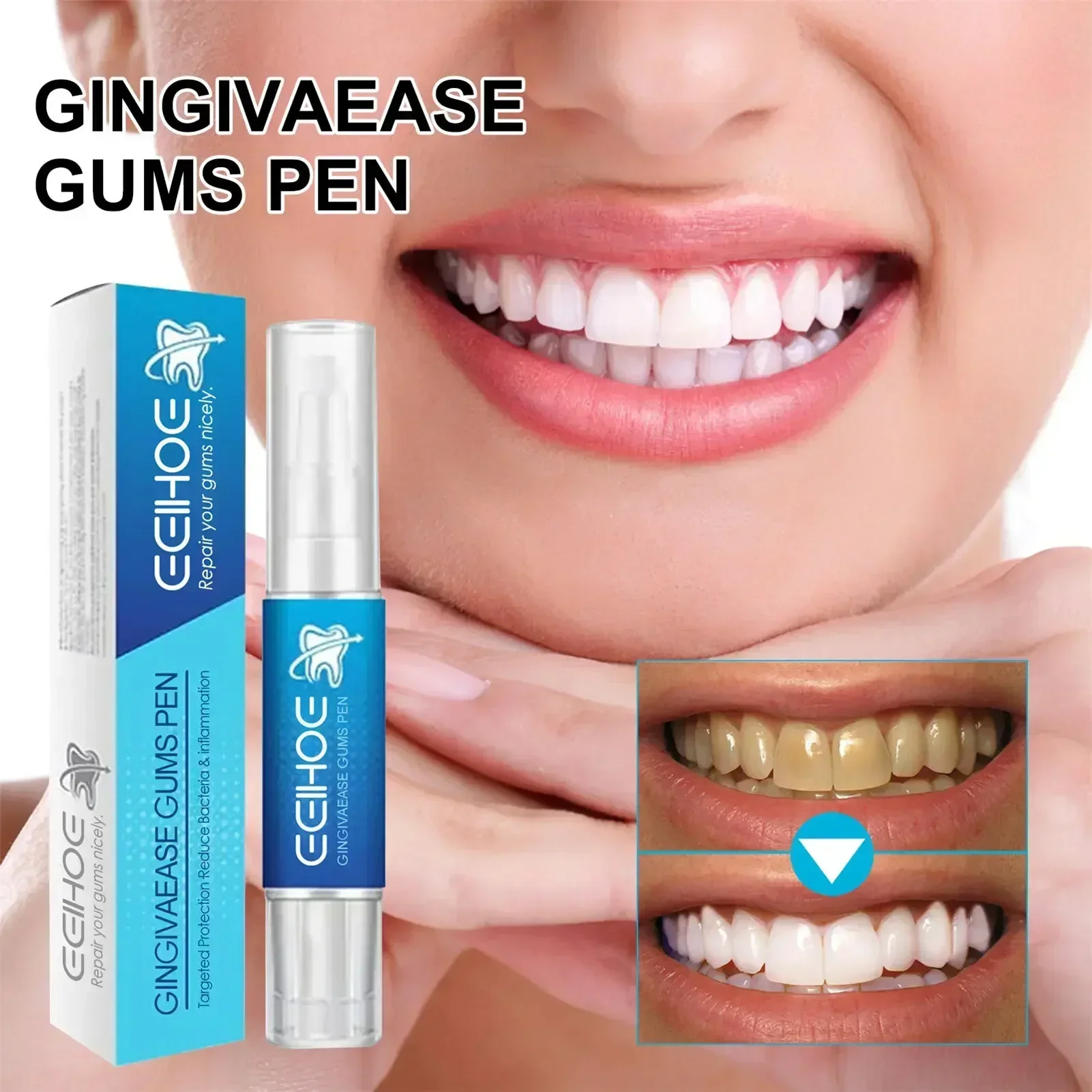 

Gum Therapy Cleaning Gel Pen Sensitive Teeth Friendly Whitening Pen Oral Care for Men and Women Teeth Whitening Teeth Cleaning