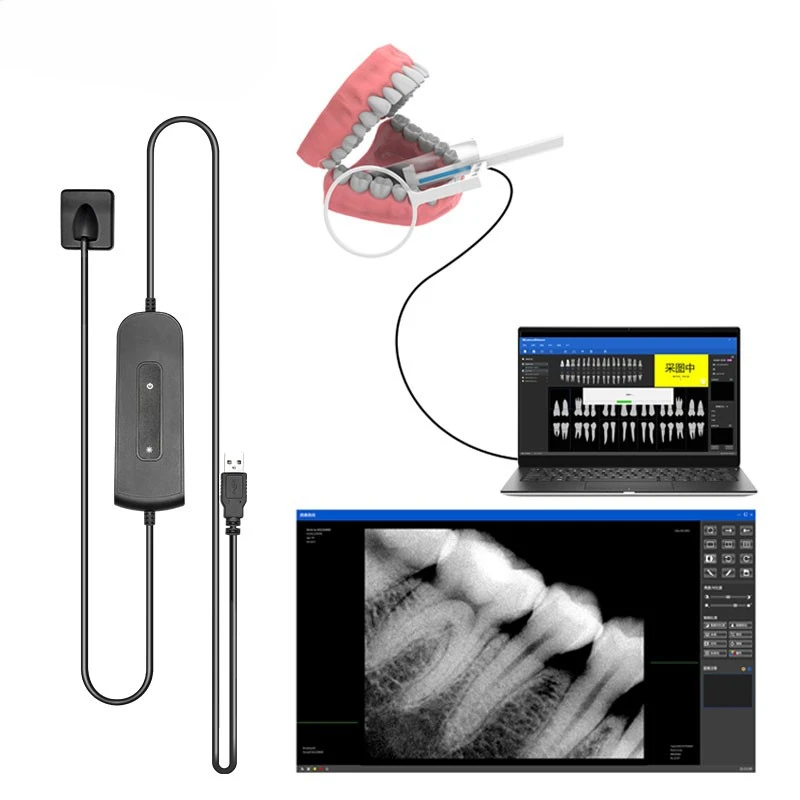 Dental Dentistry Dentist Digital Cameras Sensor X-Ray High-Frequency Rx Digital Intraoral Digital System HD Image Radiovisografo