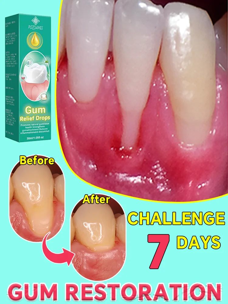 

Natural implants can eliminate all gum problems