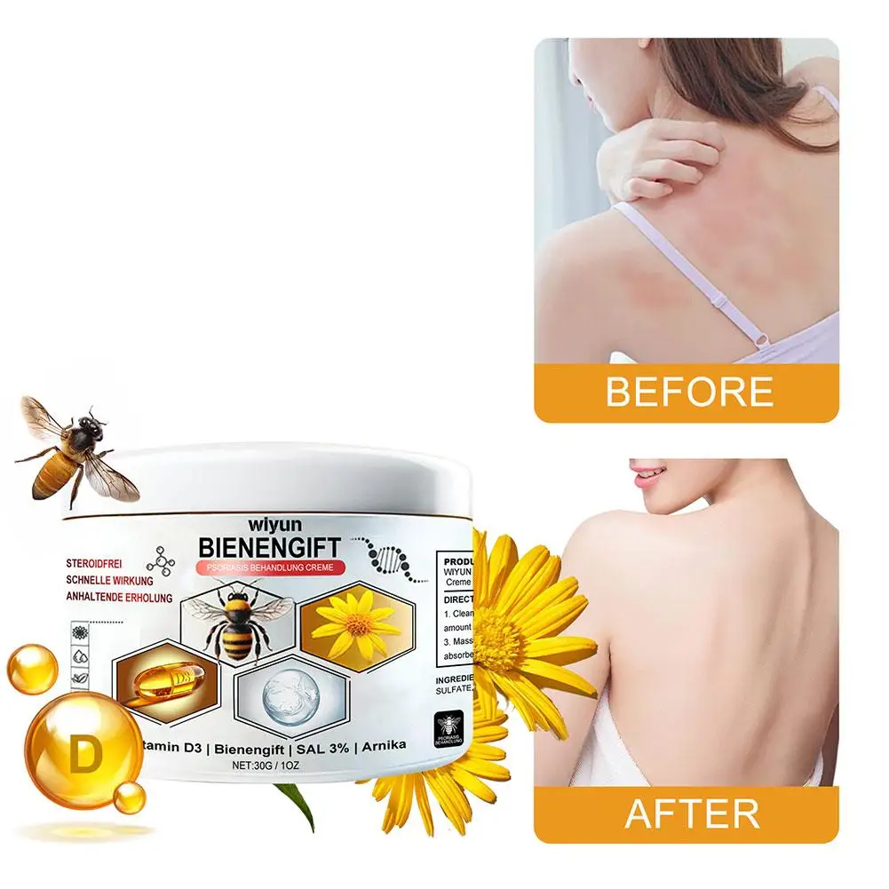 30g Bee Venoms Joint Care Cream Relieve Cervical Joint Soreness Massage Treatments Cream Bone Health Body Care Tools