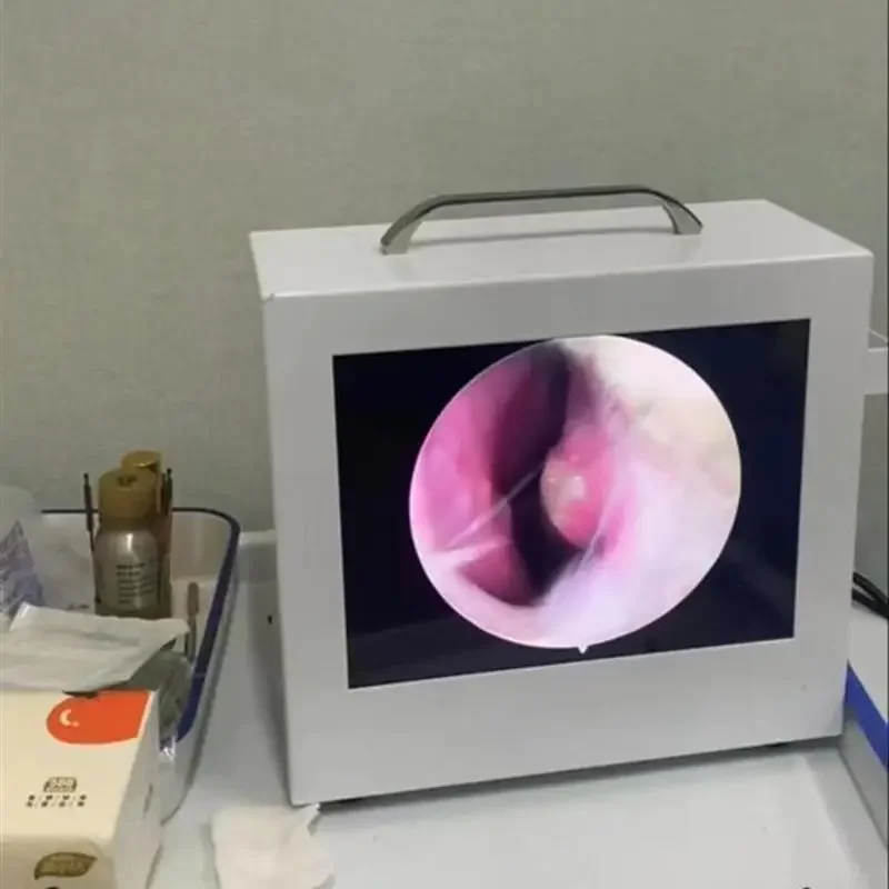 Electronic Endoscopy Viewer Endoscope Visual Otolaryngology Animal Otolaryngology Portable