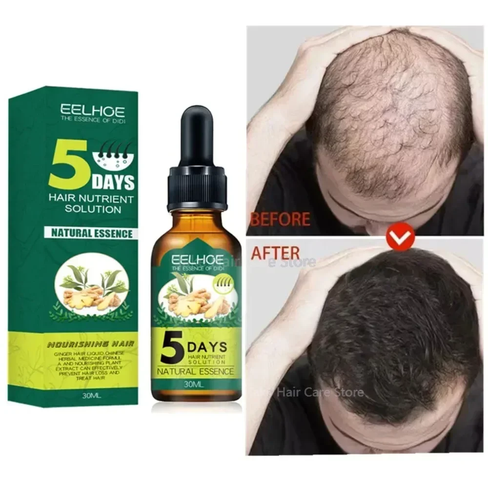 Anti Alopecia Fast Hair Growth Oil Ginger Essential Serum Hairless Baldhead Increase High Hairline Head Hair Essence Cream