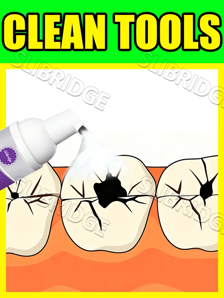 

2025 hotsale,Intraoral Mousse clean tools,free shipping,Selling Fast