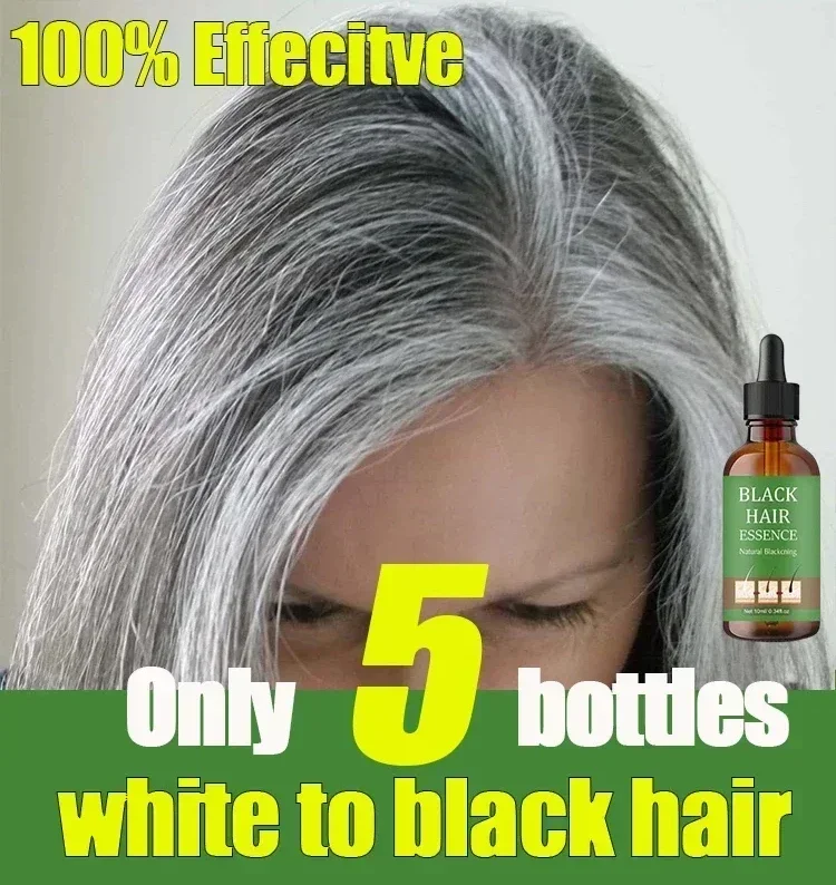 

Anti-grey hair essence Restore Natural Color: Anti-Grey Hair Serum for Healthy White to Black Hair - Effective Treatment