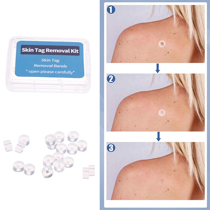 Bandes de caoutchouc pour l'élimination des étiquettes cutanées, Micro bande Non toxique, soins du visage, taupe, verrues, outils de soins de la peau, 20 pièces