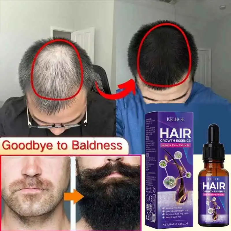 98% of buyers buy again, have more and more hair, say goodbye to baldness, thick hair,Hot selling product