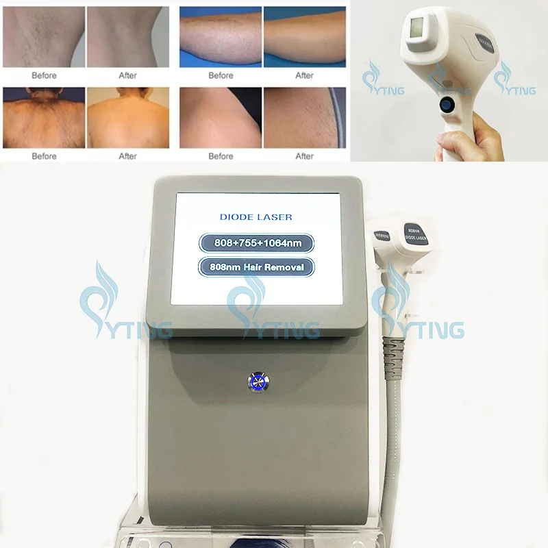 808nm 755nm 1064nm Diode Laser 20 Million Shots Hair Removal Skin Rejuvenation Machine Painless Device for Salon Spa Clinic