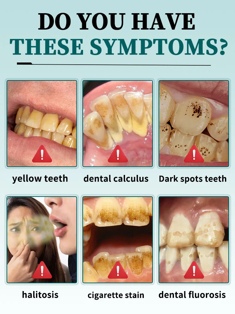 Fast and effective teeth whitening tooth protection products