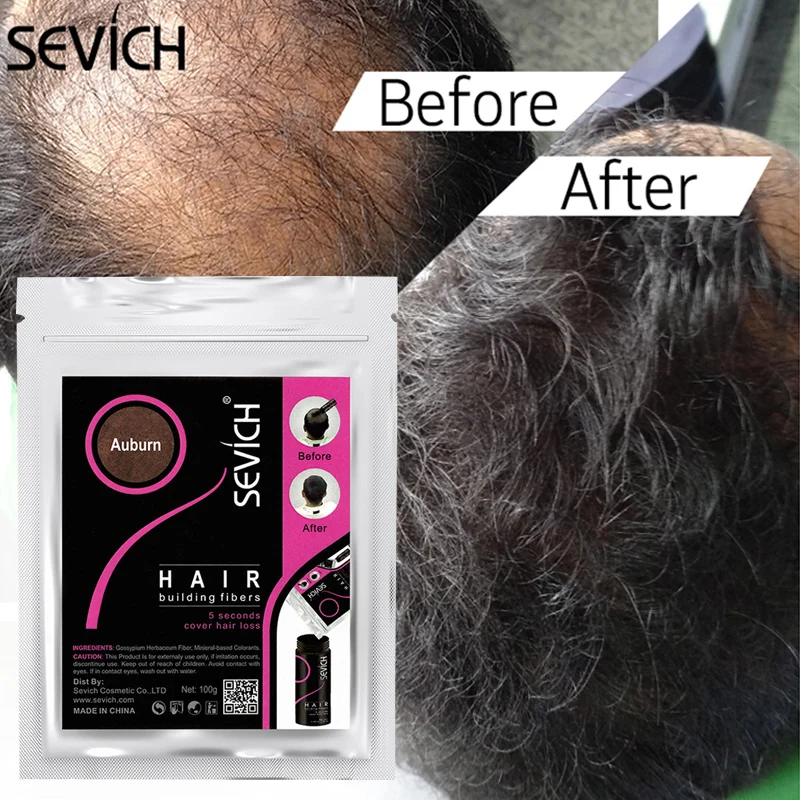 Sevich 50g Instant Hair Growth Fiber Refill 10 Colors Keratin Hair Building Fiber spray Fiber Hold Spray Powder Hair Treatment