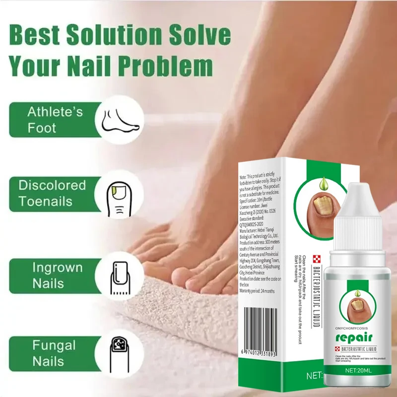 Unha fungo tratamento soro, Toe Fungal Repair Products, Mão Foot Care Remoção Gel, Anti infecção, Onicomicose Paroníquia, Novo