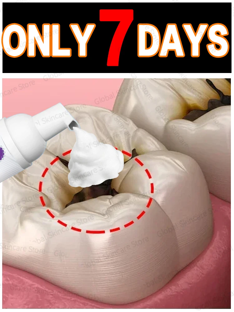 

2025 Oral Care Tools for Correcting Discolored and Damaged Inlays