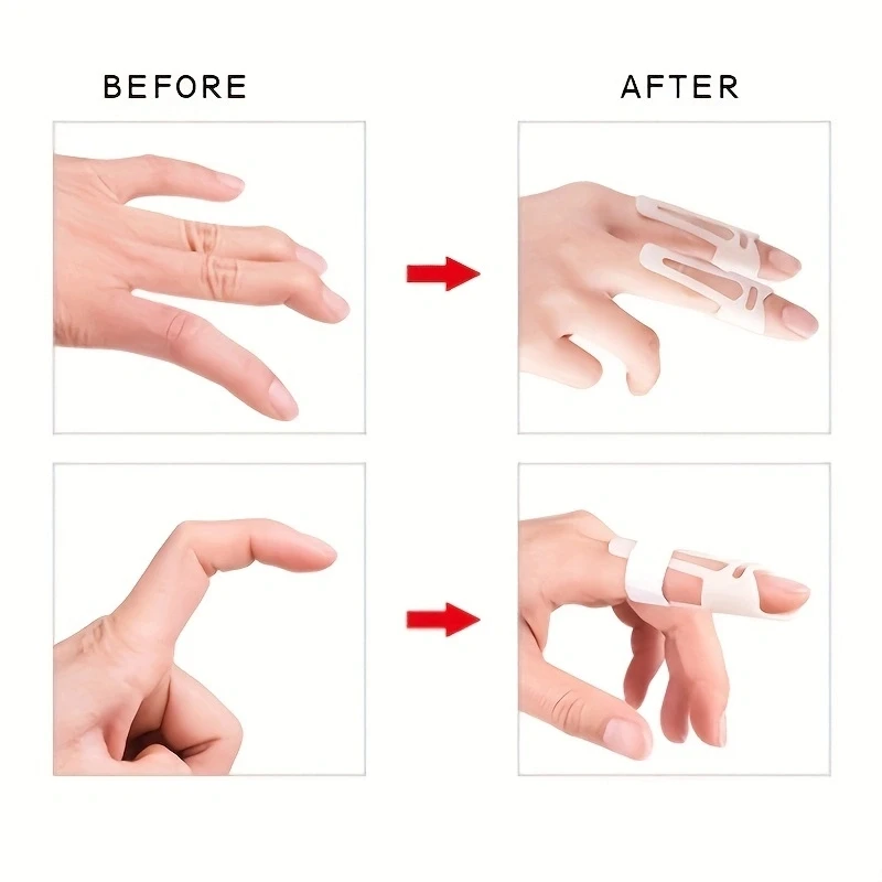 Fixed Finger Straightener Arthritis Joint Corrector Finger Support  Brace Orthopedic Correction Tool Finger Splint Brace