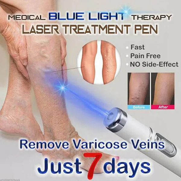 For Dropshipping Acne Laser Pen Portable Wrinkle Removal Machine Durable Soft Scar Remover Device Blue Light Therapy Pen Massage