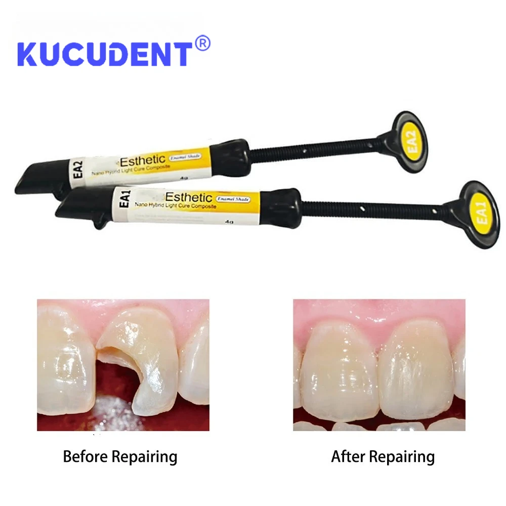 4g/シリンジ DENTEX エナメルレジン - 前歯修復用光重合型コンポジット、ナノハイブリッド充填材 (A2/A3)