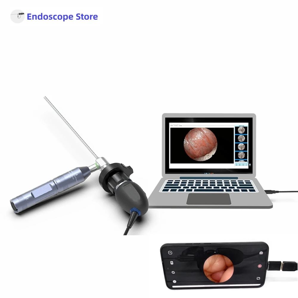Przenośny endoskop HD 1080P 60FPS Kamera USB typu C Laryng Weterynaryjny szpital dla zwierząt Wyświetlacz telefonu komórkowego