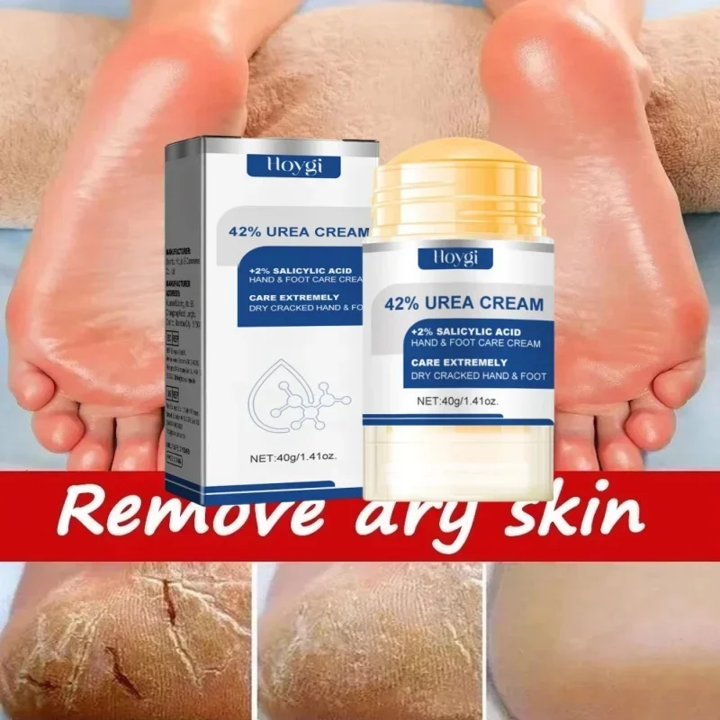 60% Urea Foot Cream Aloe Vera Ultra-hydrating Softening Dry Cracked Feet Cream Gentle Exfoliation Daily Foot Care Solution 40g