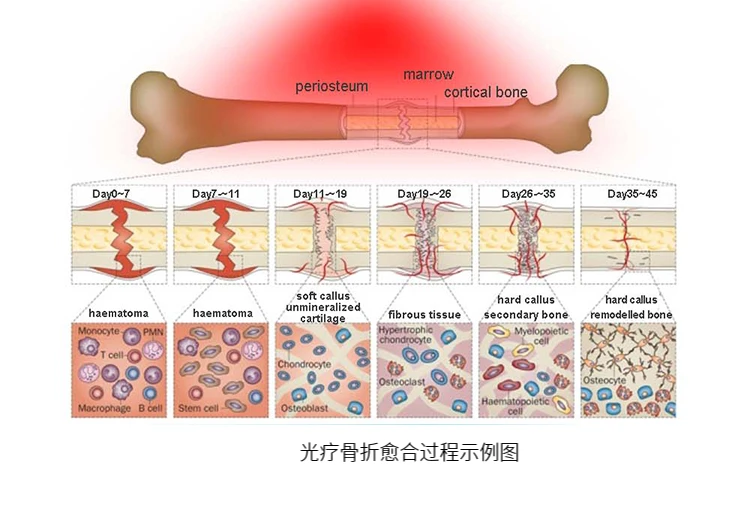 Pet infrared infrared light physiotherapy belt bone spur patella fracture lumbar spine hip joint cervical spine phototherapy