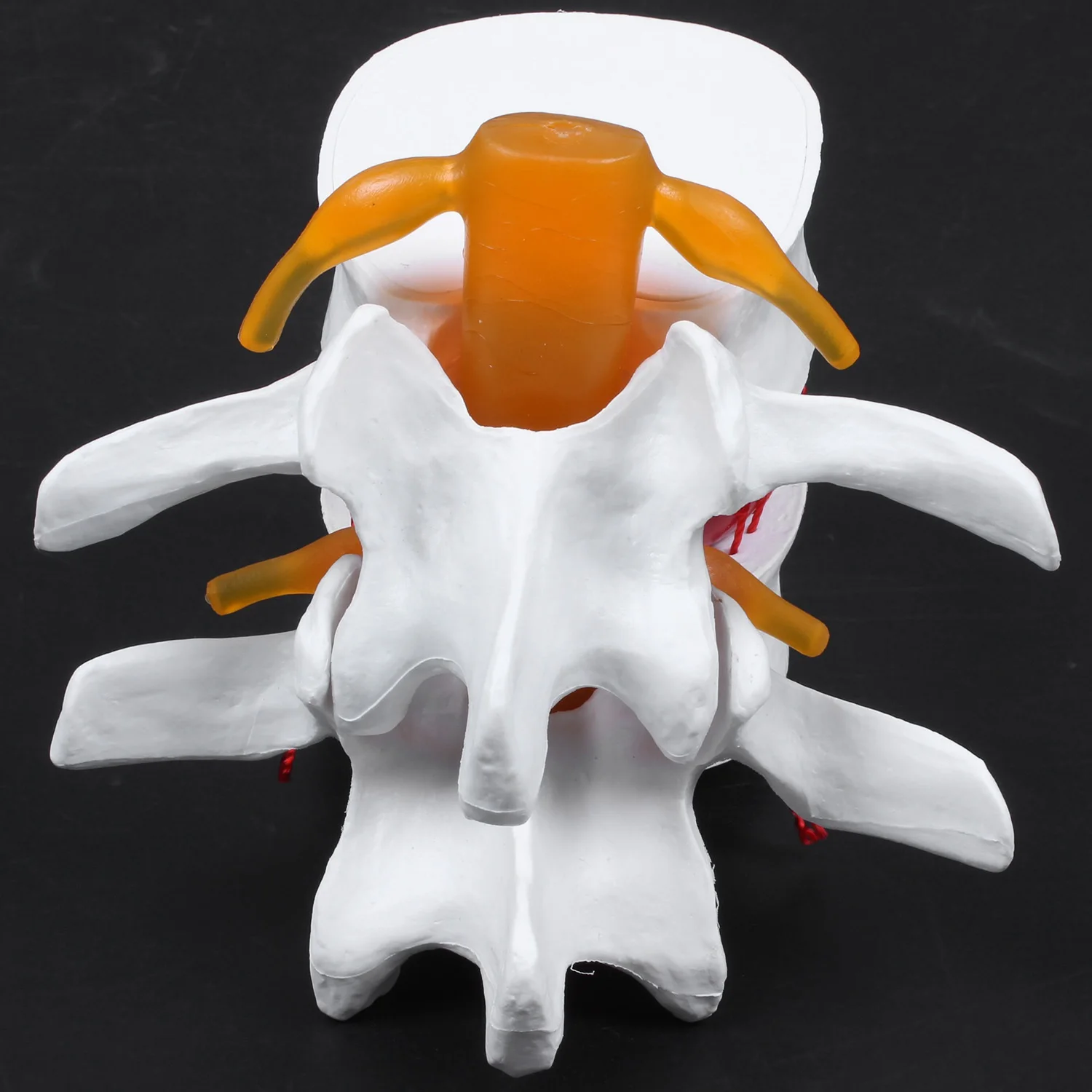 Esqueleto de anatomía humana, columna vertebral, hernia de disco Lumbar, modelo de enseñanza, cráneo cerebral, suministros escolares traumáticos, instrumento
