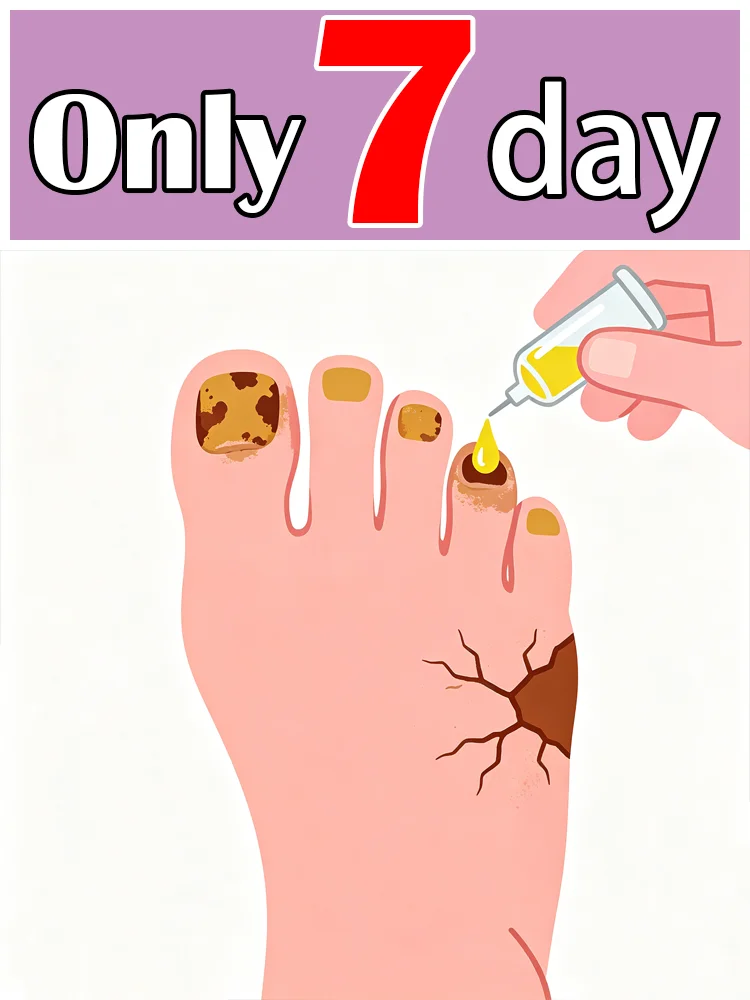 

Устройство для восстановления воздуха - Технология противоплесневой защиты - Регулируемый контроль температуры и датчики безопасности