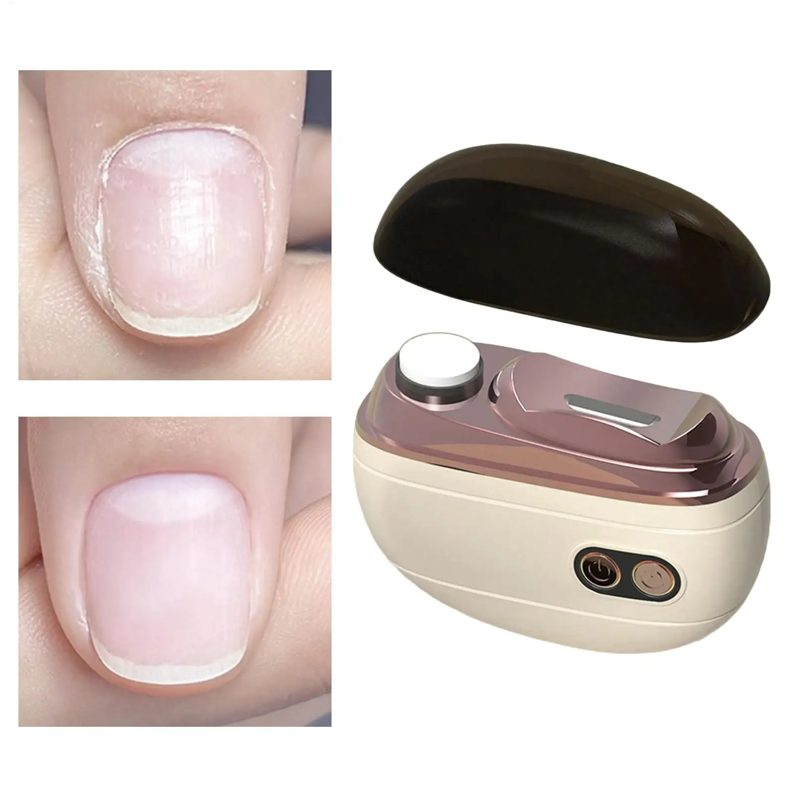 

Electric Nail Trimmer with LED Light 2-Speed Automatic 4 In1 Automatic Nail Clipper for Seniors Elderly Women Adults Kids