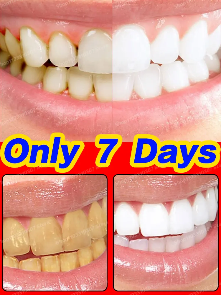 Teeth Become Whiter