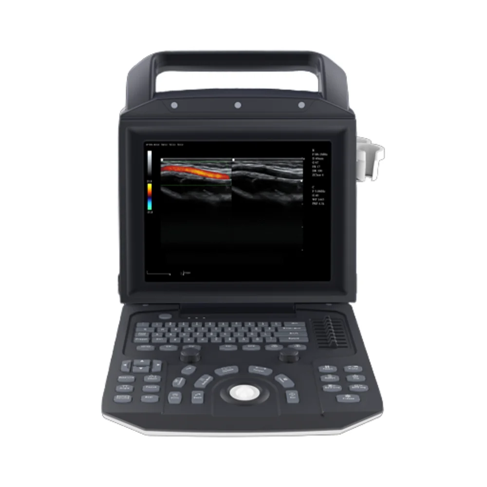 LTUB73 All-Digital Portable  Ultrasound Scanner