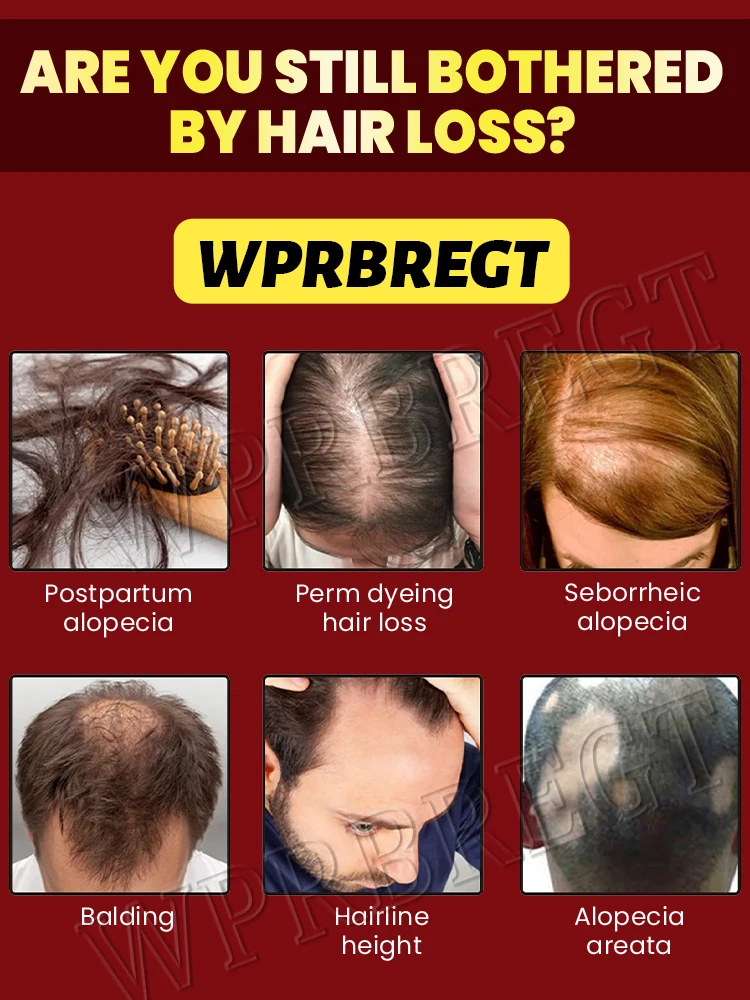 ̊خلبيش ذاكرة نمو، لحية الوجه، ذاثرى أوب سينوب من ذاقيد، تشيشت، أرمش، جميع شعر البابين، جميع شيميازابل #3