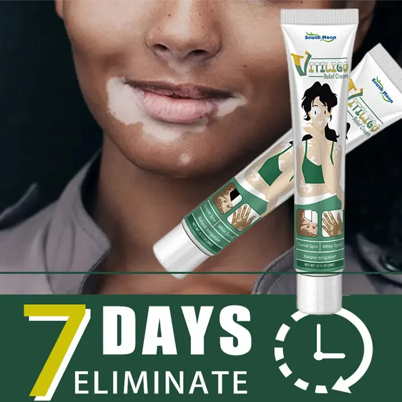 Pomada de extracto de hierbas de Vitiligo, crema de tratamiento para eliminar manchas blancas de la piel, elimina el Vitiligo